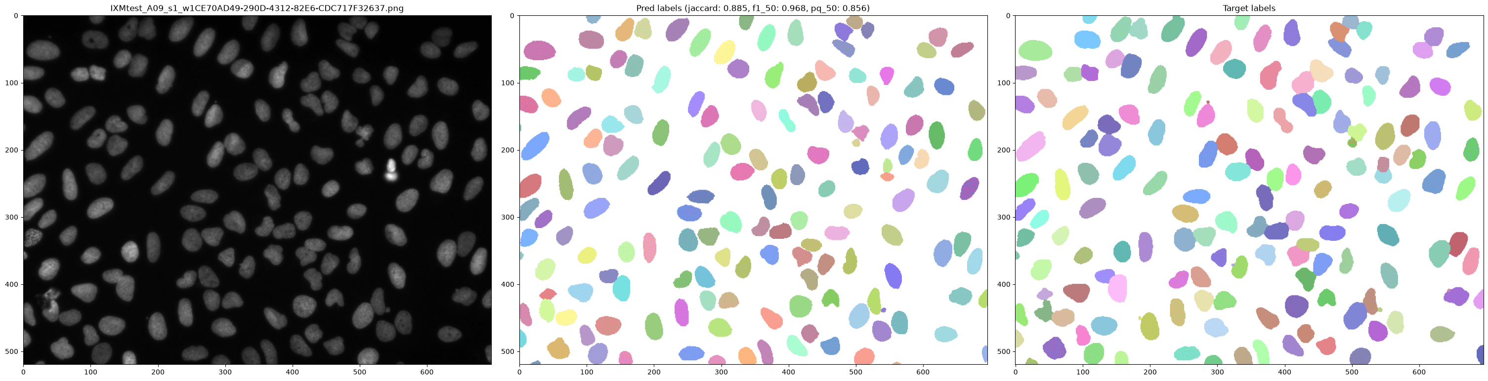 Cell Segmentation and Detection in Fluorescence Microscopy